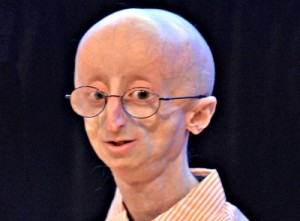 Progeria
