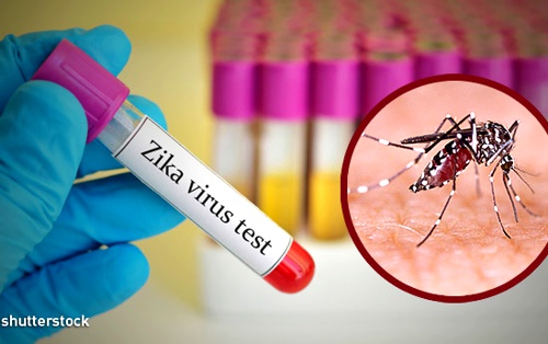 VIRUS DEL ZIKA VIRUS DEL ZIKA