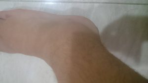 tobillo