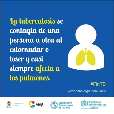 Tuberculosis Tuberculosis