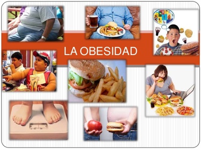 Obesidad Obesidad