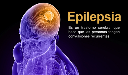 Sacar a la epilepsia de la sombra Sacar a la epilepsia de la sombra
