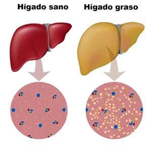 Día mundial de lucha contra la Hepatitis Día mundial de lucha contra la Hepatitis