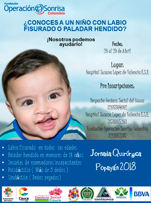 Operación Sonrisa