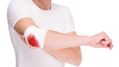 Día Mundial de la Hemofilia