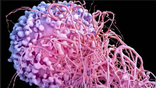 el cancer