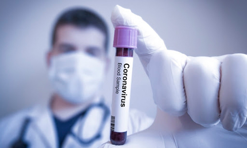 10 nuevas muertes por coronavirus Sigue creciendo el contagio. 10 nuevas muertes por coronavirus