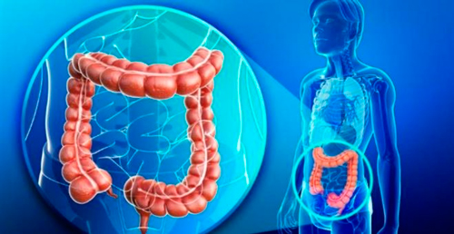 Cáncer de colon La importancia de la prevención Cáncer de colon La importancia de la prevención
