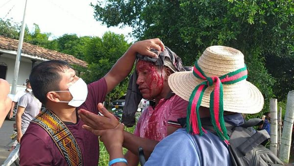 Indígena herido en La Emperatriz, Caloto Indígena herido en La Emperatriz, Caloto