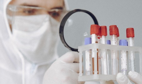 Infórmese sobre las pruebas diagnósticas de laboratorio de COVID-19