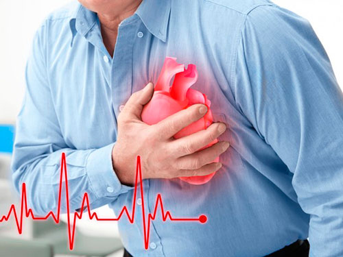 Cada 8 minutos y medio muere un colombiano por enfermedades cardiovasculares