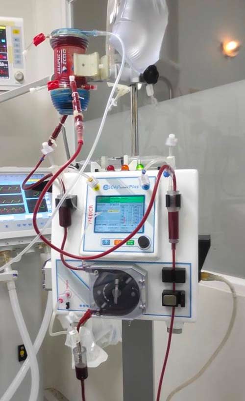 Hospital San José cuenta con nueva tecnología para atender pacientes de alta complejidad