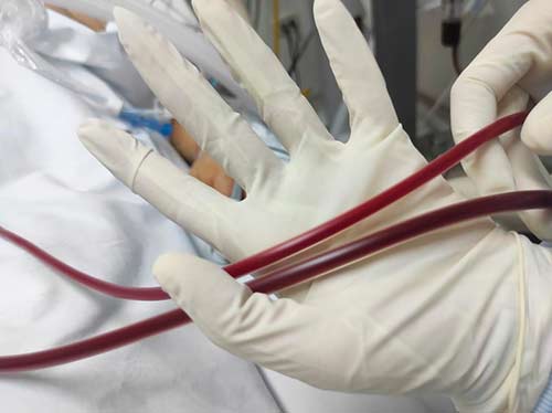 Hospital San José cuenta con nueva tecnología para atender pacientes de alta complejidad