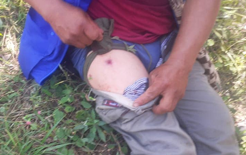 Heridos a bala integrantes de “Minga Indígena” en Caldono.
