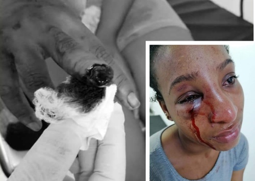 Presunto intento de feminicidio en Buenaventura – Imágenes sensibles. Presunto intento de feminicidio en Buenaventura – Imágenes sensibles.