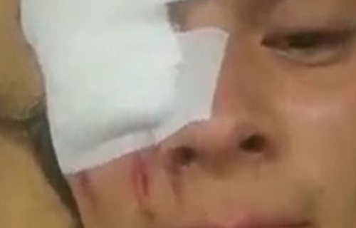 "Con el ojo que veo, sigo viendo un mejor país": Ortega "Con el ojo que veo, sigo viendo un mejor país": Ortega