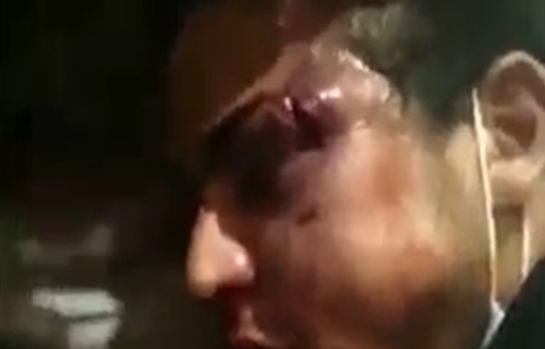 "Con el ojo que veo, sigo viendo un mejor país": Ortega "Con el ojo que veo, sigo viendo un mejor país": Ortega