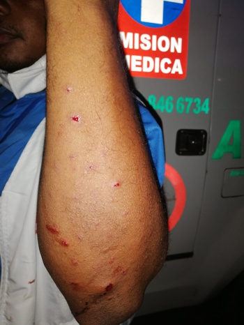 Disparan contra ambulancia de misión médica en el Cauca