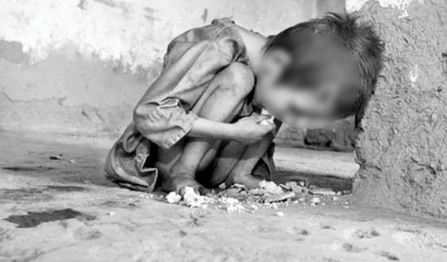 La tierra del olvido - Colombia - Niño con desnutrición