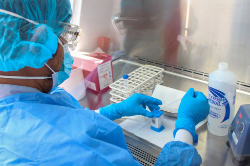 No vacunados, los más afectados durante el cuarto pico de contagios No vacunados, los más afectados durante el cuarto pico de contagios