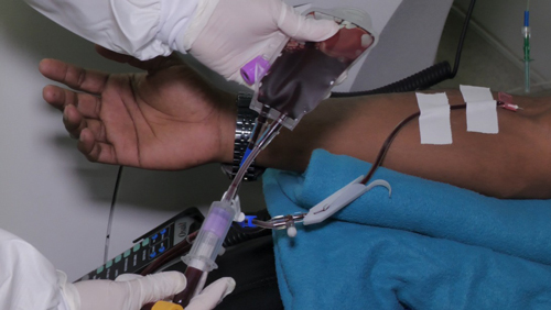 HUV aplicará prueba de malaria a los donantes de sangre HUV aplicará prueba de malaria a los donantes de sangre